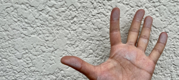 チョーキング現象